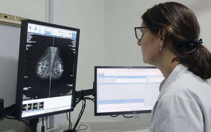 En Provincia se comenzará a indicar la primera mamografía a los 40 años