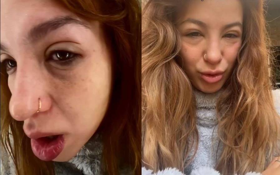 Preocupa Flor Vigna tras publicar impactantes fotos: “Cuando no me animaba”