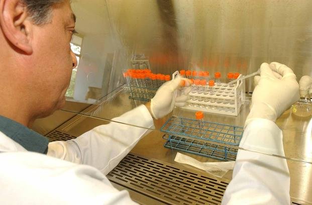 Japón desarrolla test para detectar el cáncer de páncreas en su fase temprana