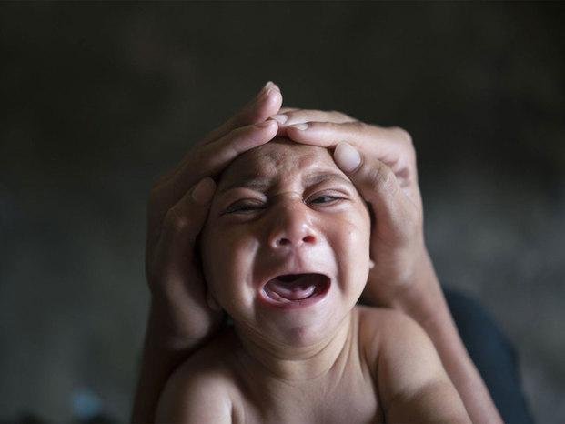 El zika dejó de ser  emergencia para la Organización Mundial de la Salud