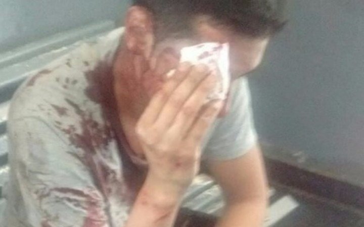 Otra vez roban y arrojan a un pasajero de un vagón del tren Belgrano Norte