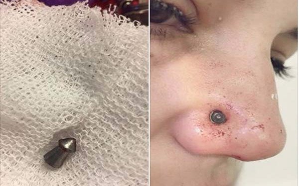 Una mujer recibió un balinazo mientras paseaba junto a sus hijos en Plaza Paso