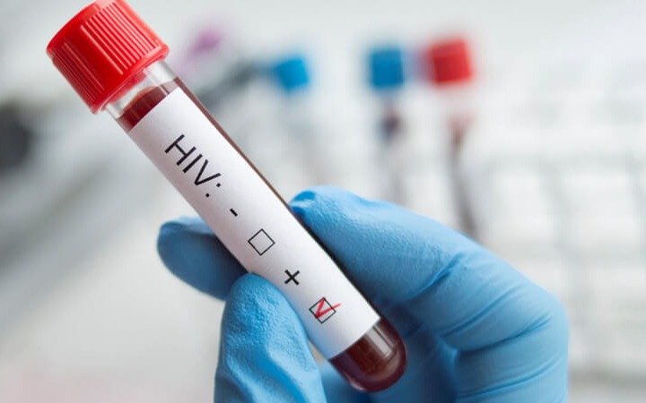 El 98% de las nuevas infecciones con VIH en Argentina son por relaciones sexuales sin protección