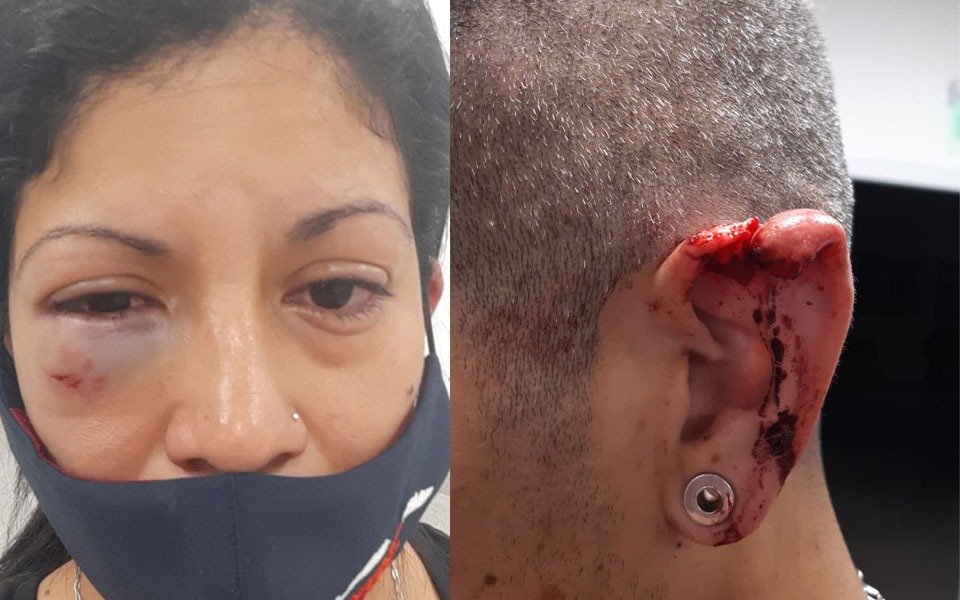 Denuncian feroces golpizas a dos hermanos en el barrio Cabezas: "La gente está cansada de estos malvivientes"