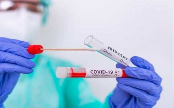 Coronavirus en Argentina: 11.100 contagios en el día y 248 nuevas muertes