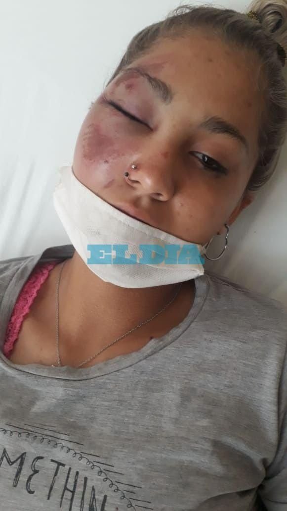 Salvaje ataque de una banda de motoqueros que domina una zona de Punta Lara