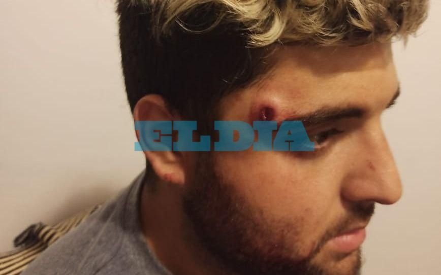 Balearon en la cabeza a un jugador de Los Tilos y se salvó de milagro