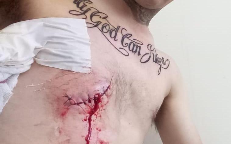 Salvaje ola delictiva castiga al Barrio Hipódromo y los vecinos piden “más policías”