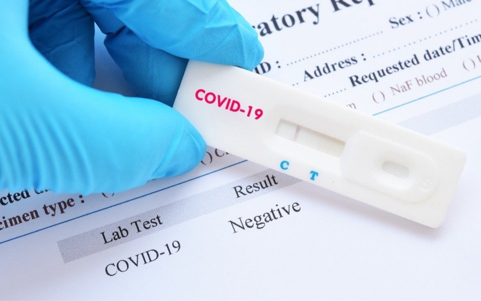 La ANMAT prohibió un test de diagnóstico rápido de COVID