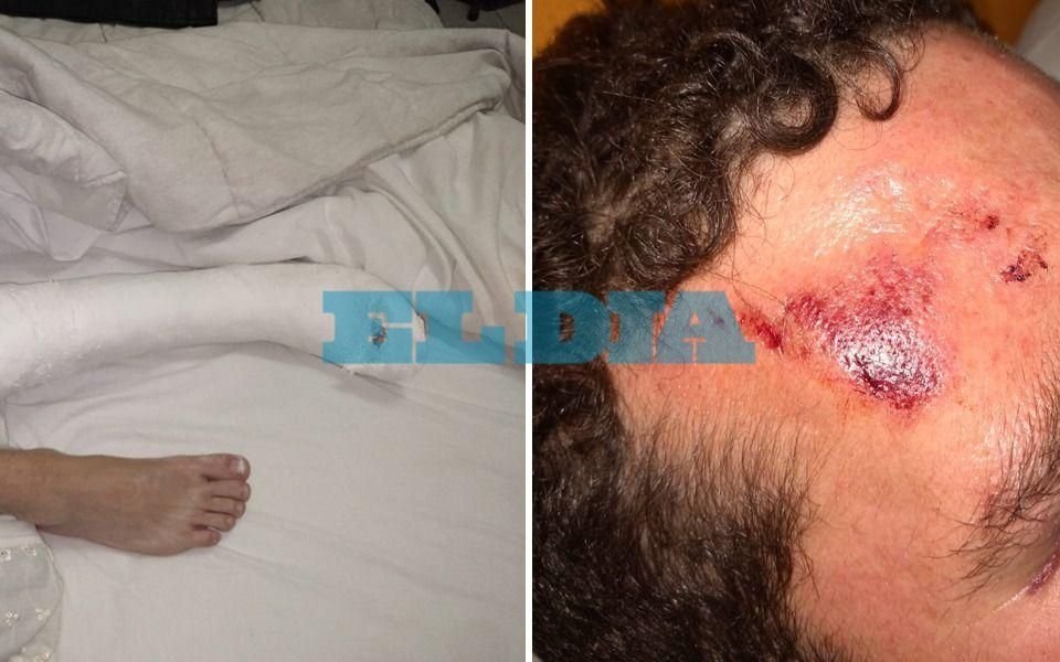 Brutal golpiza a un joven a la salida de un boliche en La Plata