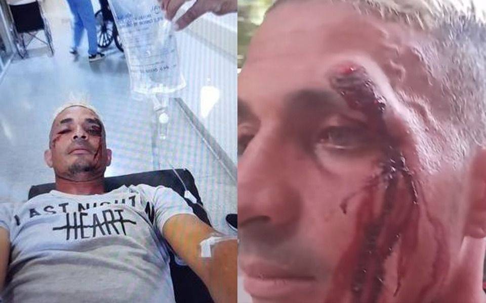 Otra jornada con violencia en la Liga y un jugador hospitalizado