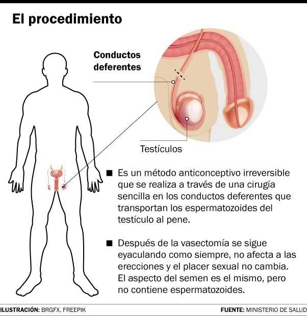Vasectomías: su demanda se disparó en el país