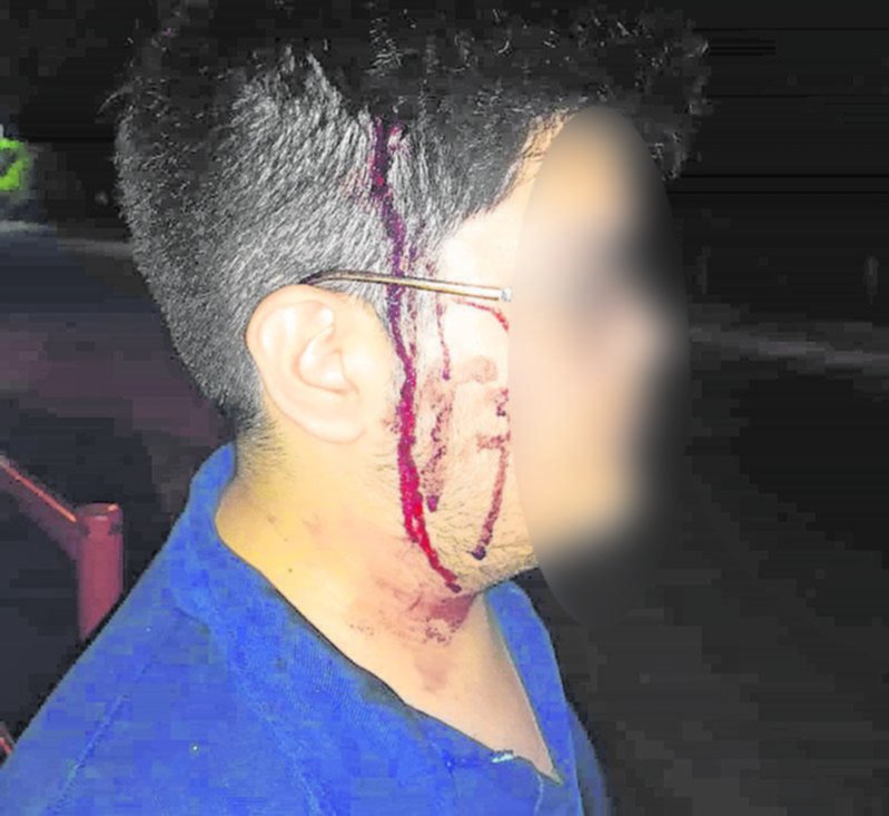 Robo y golpiza a un estudiante en la puerta de la Facultad de Informática