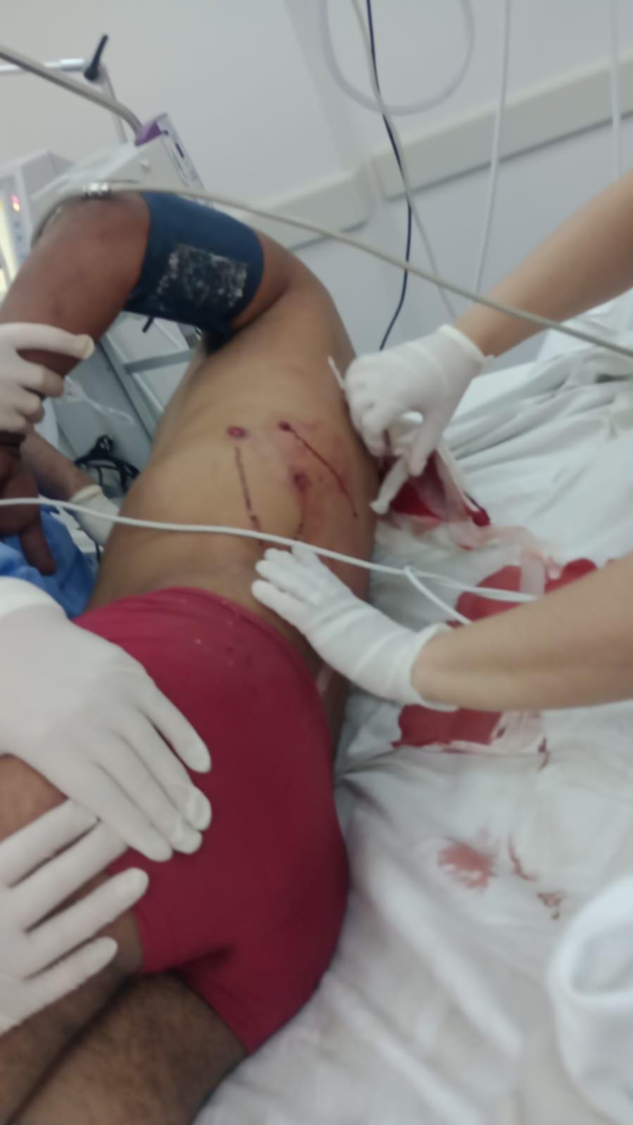 Liberaron a uno de los detenidos tras el tiroteo