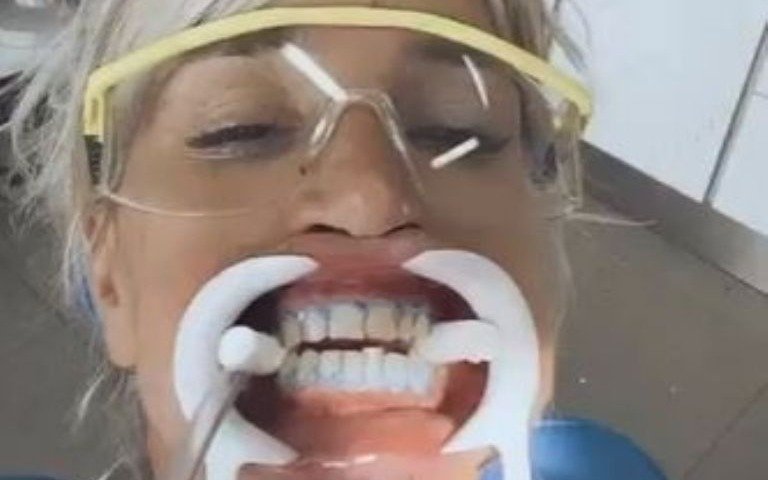 Tratamiento dental para Florencia Peña en la previa de su boda: todos los detalles