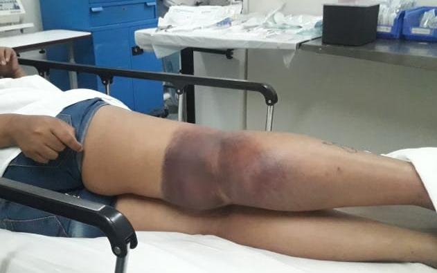 Al borde de la muerte por revisar el saldo de la SUBE