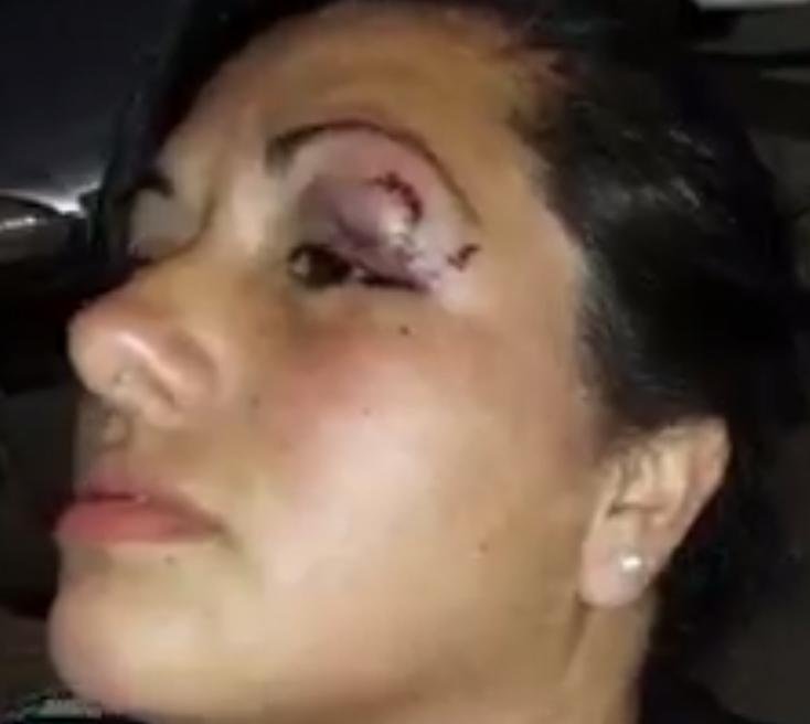 Golpiza en una comisaría de Berisso: denuncian que la causa está trabada