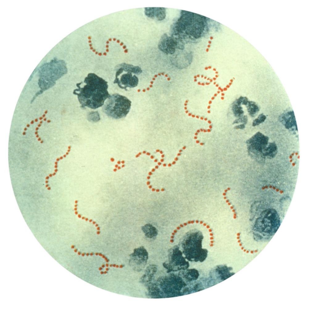 Bacteria invasiva: alerta por la disparada de casos