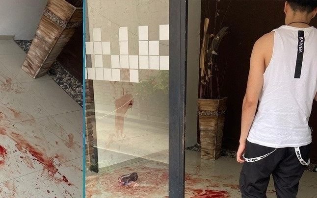 Gritos, estado de euforia y sangre en un edificio de La Plata: un joven "fuera de sí"