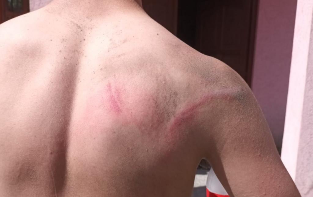Qué se sabe del violento ataque en un partido de juveniles de la Liga Amateur Platense