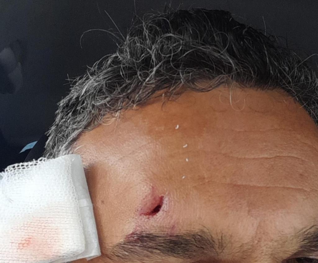 Salvajes y desalmados: brutal paliza a padre e hijo en otro robo al filo de una tragedia en La Plata
