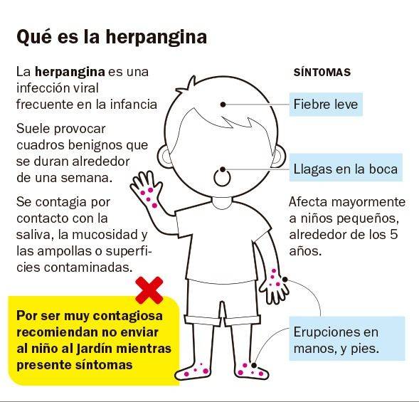 Alerta estacional: resurge la enfermedad de boca, manos y pies
