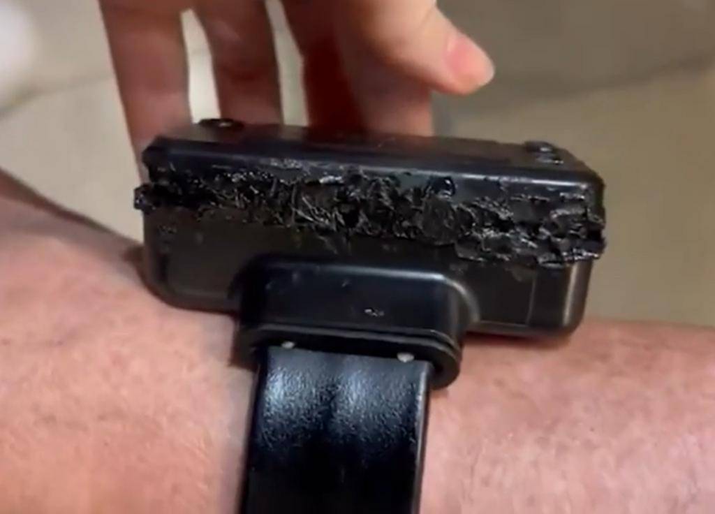 Quemó la tobillera: Bolsonaro y su plan de escape berreta que no prosperó