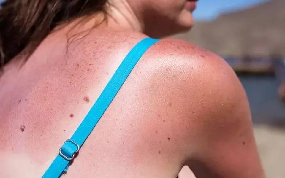 Trabajo interdisciplinario para reducir la mortalidad: La Plata reúne a expertos en tumores cutáneos