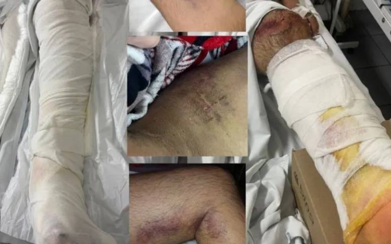 Familia de vecino de Solano herido en choque inicia una colecta en Quilmes para su cirugía