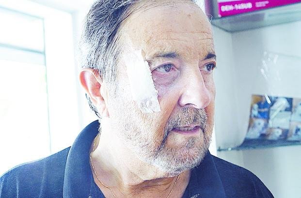 Asaltan, golpean y maniatan a un comerciante en calle 13
