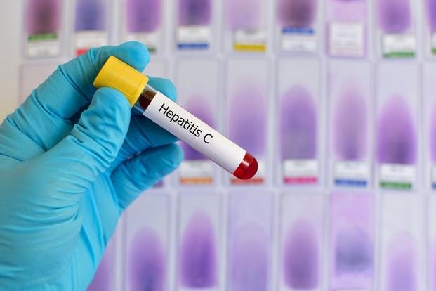 Recomiendan test de hepatitis C “al menos una vez en la vida”