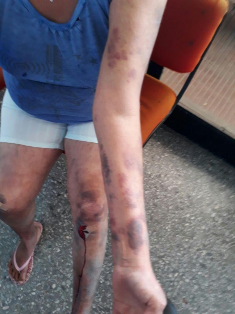Una mujer denunció a su pareja por una brutal golpiza en Altos de San Lorenzo