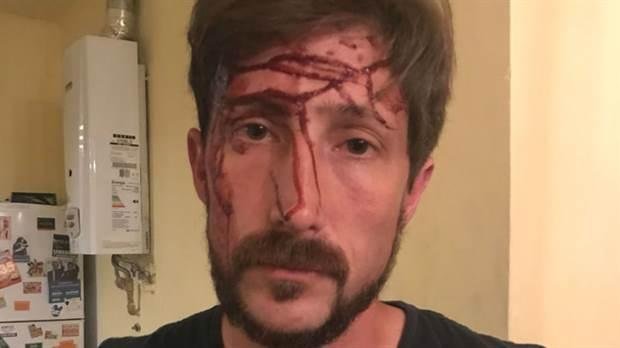 Investigan salvaje ataque a un concejal en San Martín, con golpes y amenazas