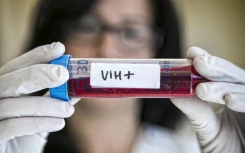 Un estudio francés abrió una puerta para la eliminación de células infectadas de VIH