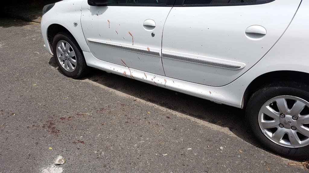 Policía complicado: el trapito recibió dos tiros y uno fue a quemarropa
