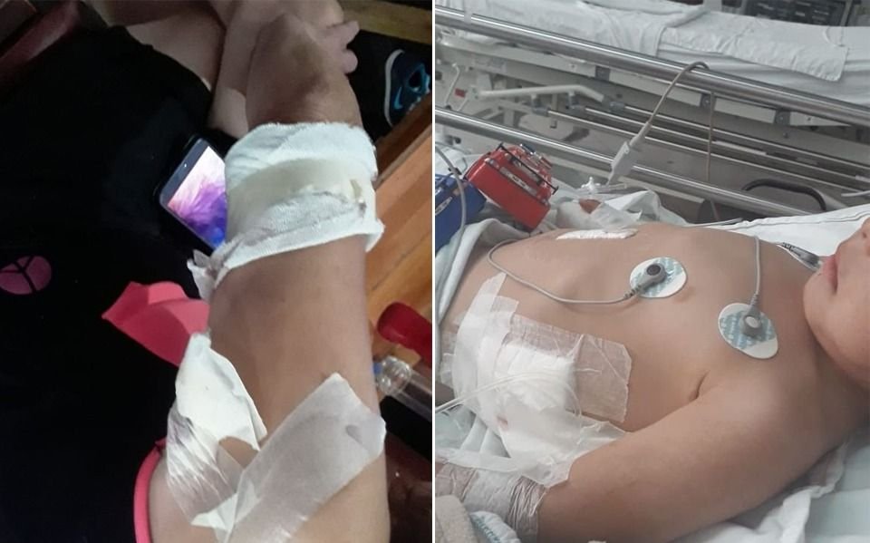 Perros salvajes en Los Hornos: nenito con graves heridas tras el ataque de dogos y pitbull