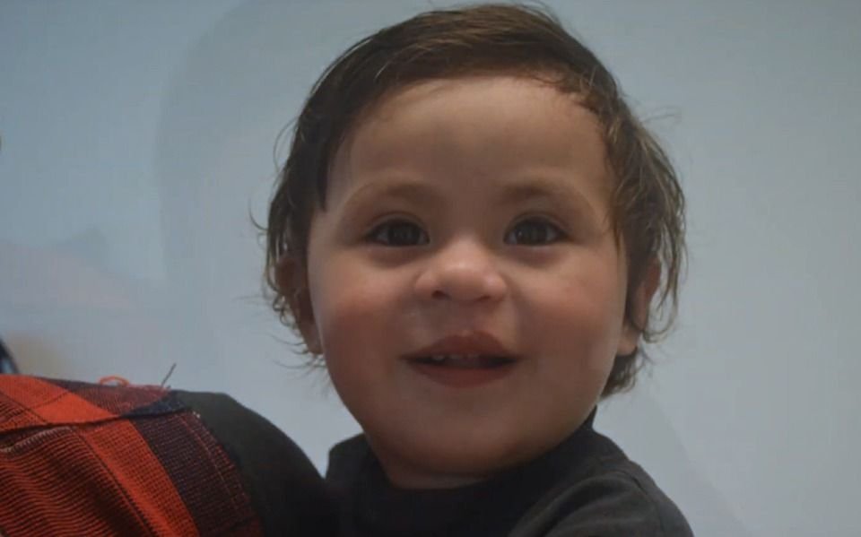 "Volver a tener sonrisa": Buscan ayuda para operar a niños con labio leporino