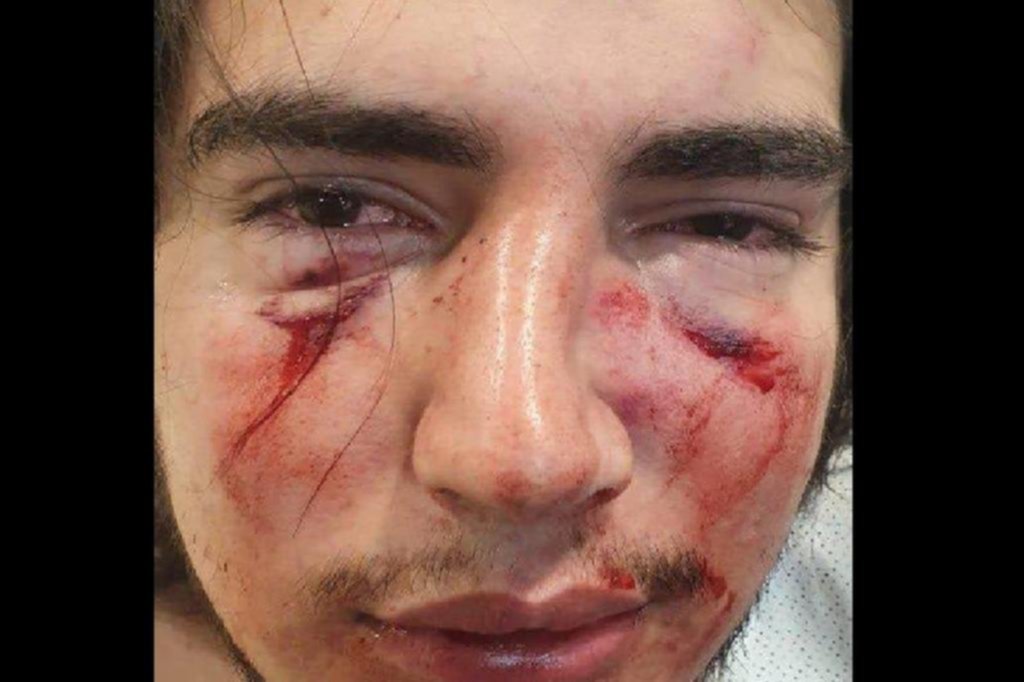 Denuncian por una agresión “en manada” a 4 rugbiers cordobeses