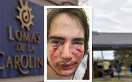 Dos rugbiers imputados por la feroz golpiza a un joven 