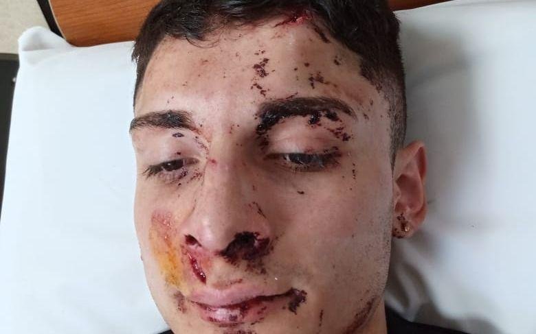 Madrugada violenta en City Bell: en patota, mandaron a un joven al hospital