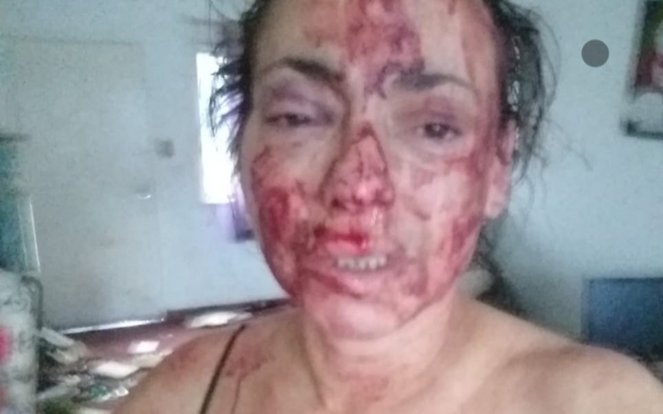Continúa internada en Romero la mujer agredida por su esposo médico