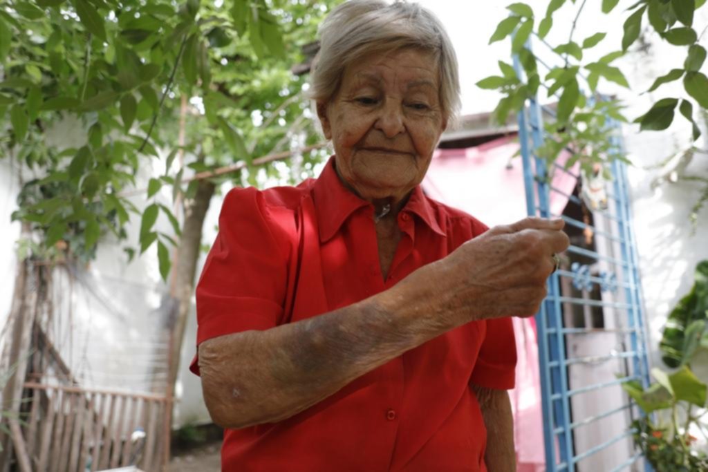 Feroz ataque a jubilada: tiene 91 años y la torturaron