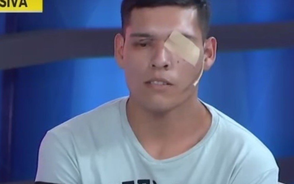 Detienen a dos policías por balear en el rostro a un joven y dejarlo sin la visión de un ojo
