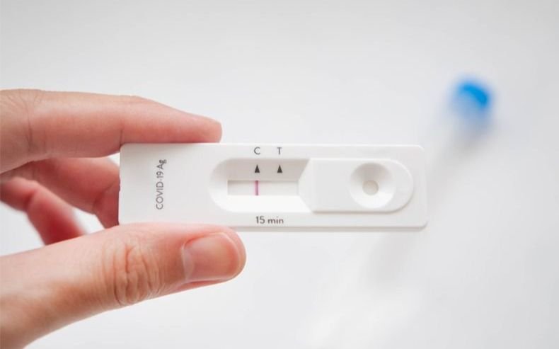 ¿Para cuándo estiman que podrían comprarse en farmacias los autotest del Covid?