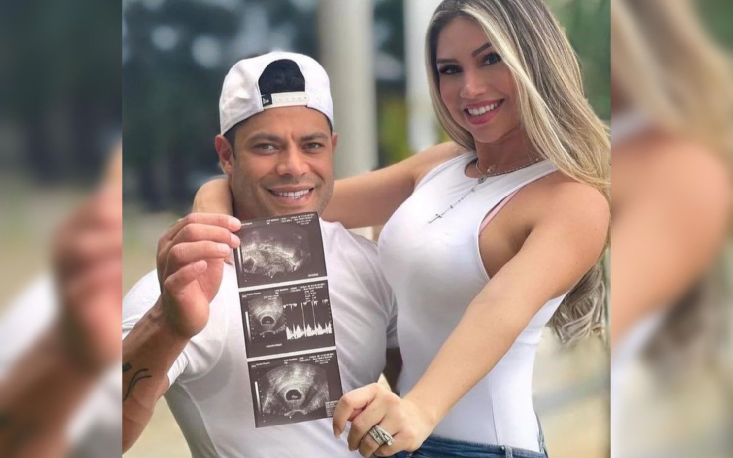 Hulk, el futbolista brasileño, será padre con la sobrina de su exesposa