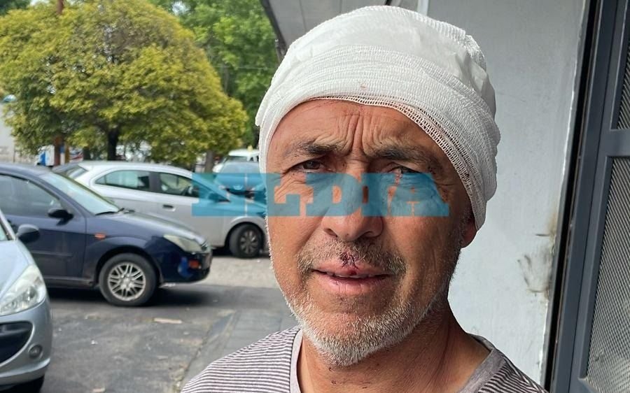Pesadilla en La Plata: "Tres ladrones me partieron la cabeza para robarme en mi casa"