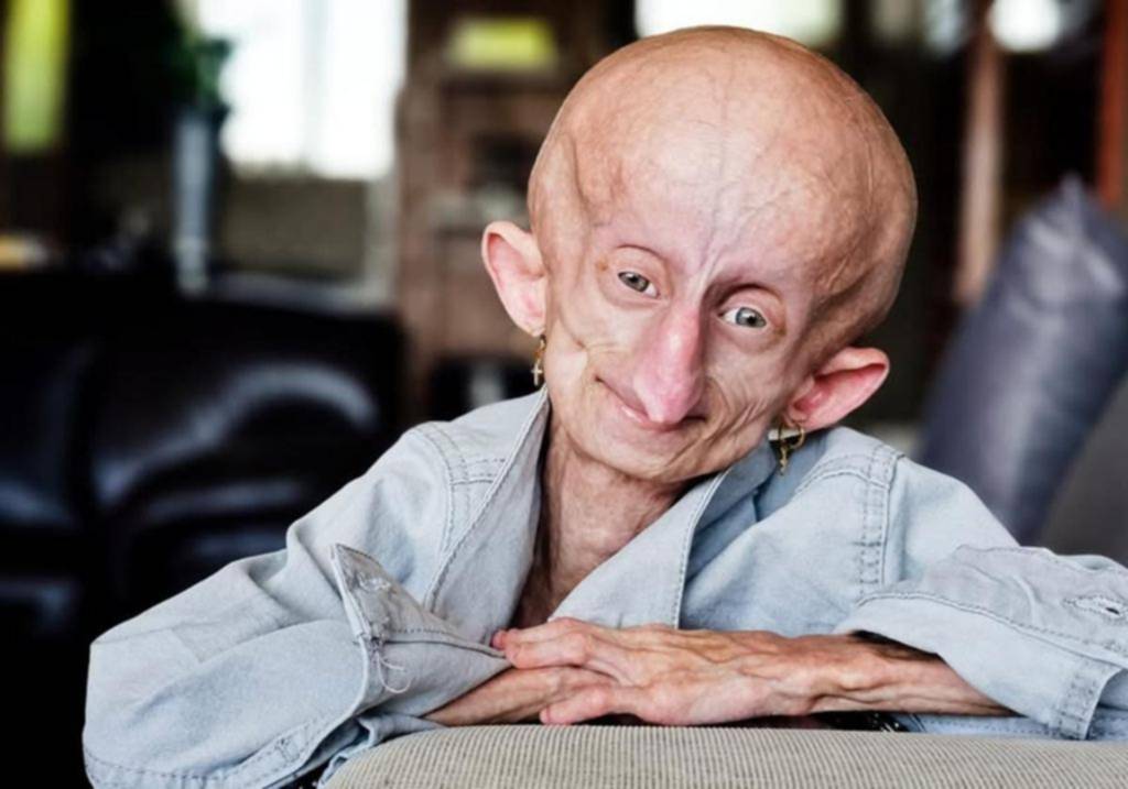 Adiós a Beandri Booysen, tiktoker y voz de la esperanza
