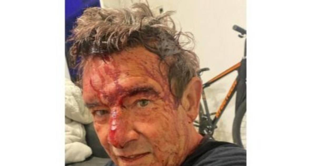 Recibió culatazos y un tiro: salvaje asalto a un vecino de City Bell y ...