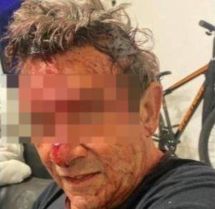 Culatazo, sangre y temor: otro robo al filo de la tragedia en City Bell