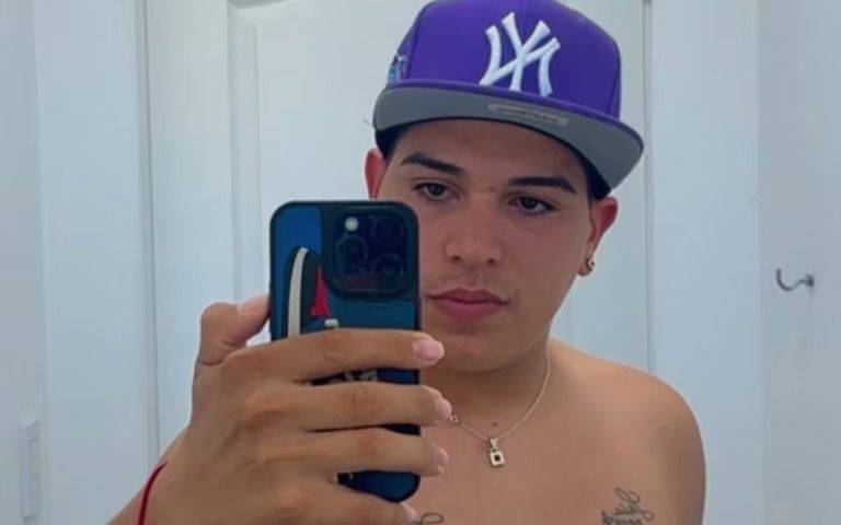 Las impactantes cicatrices de Thiago Medina tras el terrible accidente en moto: "Gracias a ellas sigo vivo"